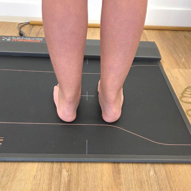 pied plat adulte bilan posturale orthopedie chauveau